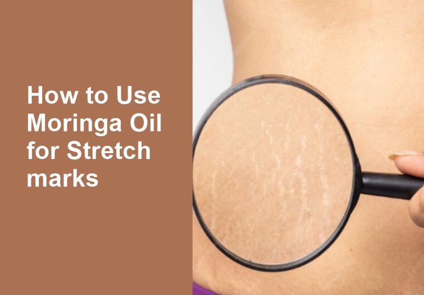 How to Use Moringa Oil for Stretch Marks