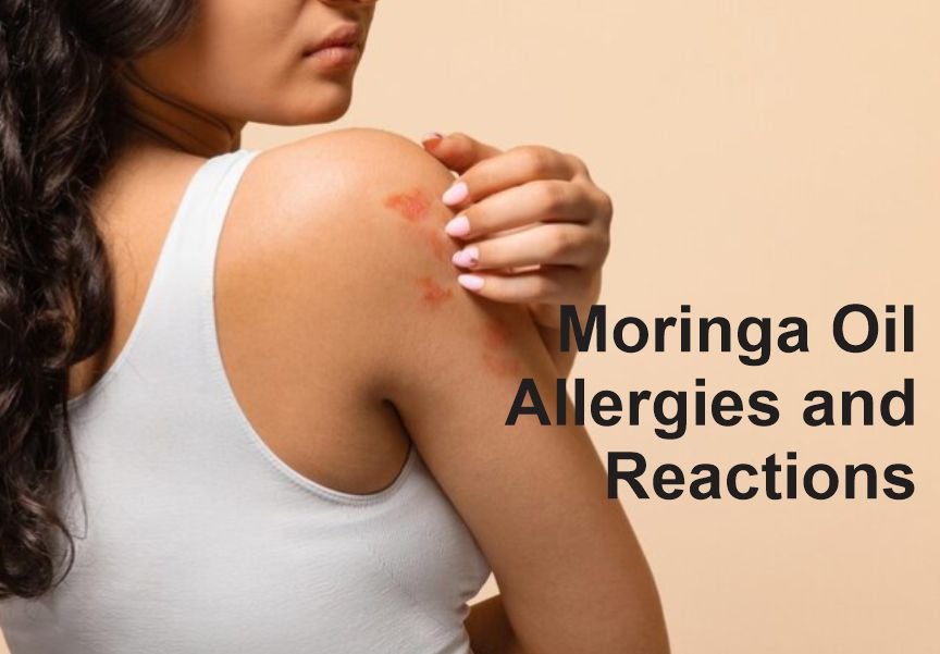 Example of Moringa Oil Allergies and Reactions