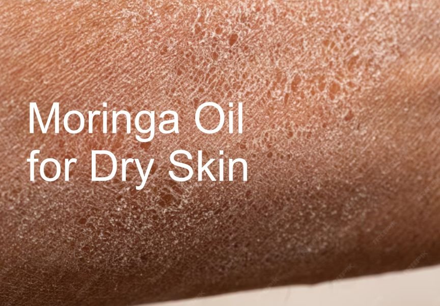 Natural Moringa Oil for Dry Skin